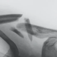 34